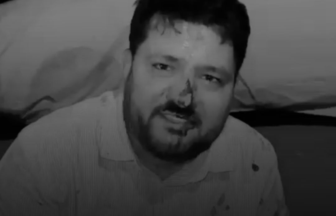 Anand: કોંગ્રેસે આણંદ નગરપાલિકા ચૂંટણીના ઉમેદવાર પર હુમલો કરવાનો આરોપ લગાવ્યો, તેને ‘લોકશાહી પર હુમલો’ ગણાવ્યો